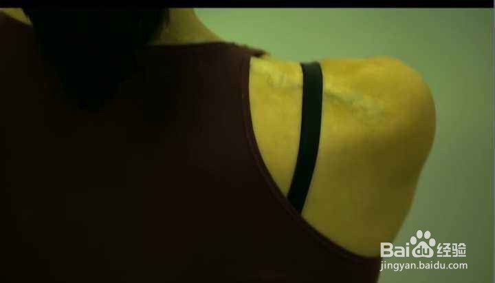 怎么祛陈年旧疤