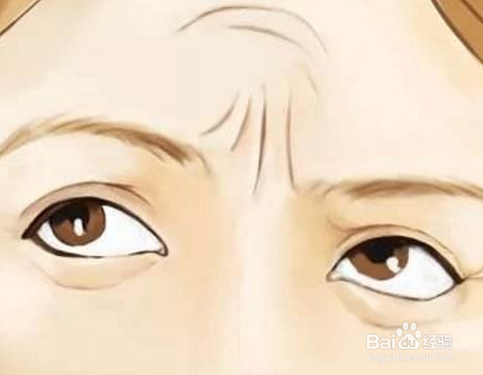 如何去掉抬头纹