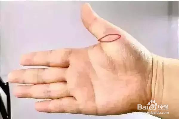 捏捏手指预防7大疾病