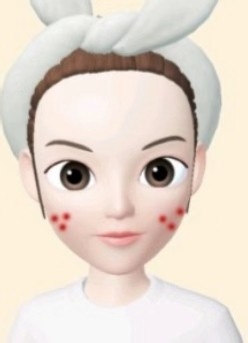 脸上长痘的原因和治疗方法你学会了吗