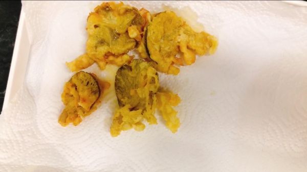 外卖同款炸蘑菇