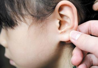 哪些可能性因素会使宝宝致聋