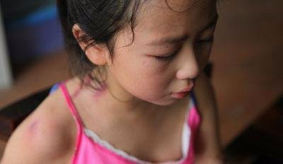 夏天带孩子要注意什么？