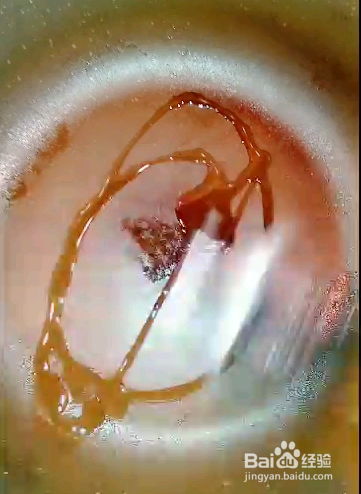 烧木耳的做法