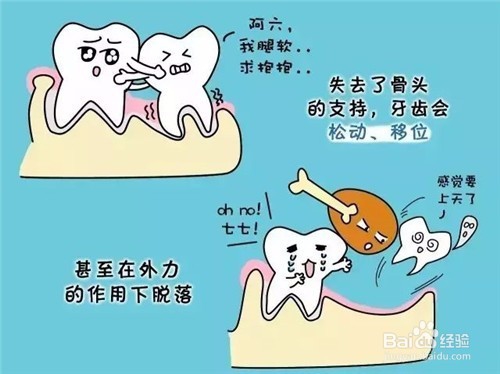 牙齿松动了该怎么办 牙齿松动怎么修复