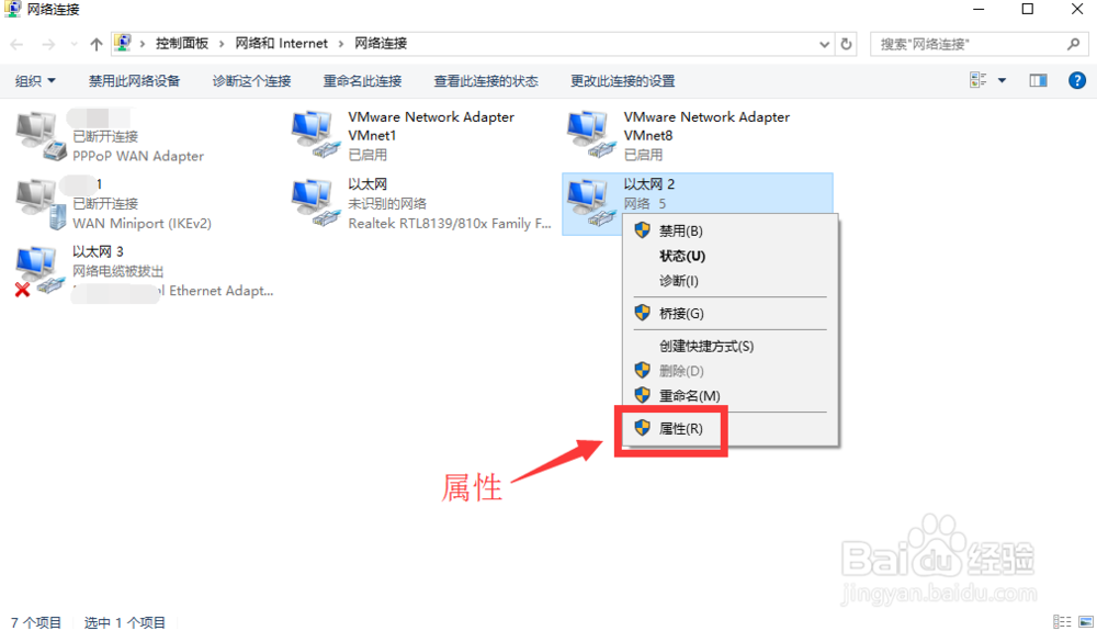 怎样设置本地连接ip