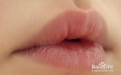 嘴唇干裂脱皮的原因是什么