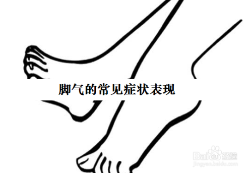 脚气的常见症状表现