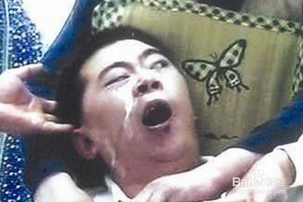 癫痫病怎么治疗