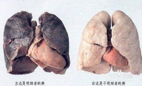 如何快速戒烟