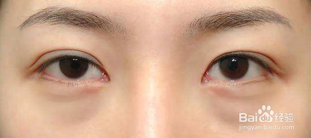 怎么化妆泪沟和黑眼圈