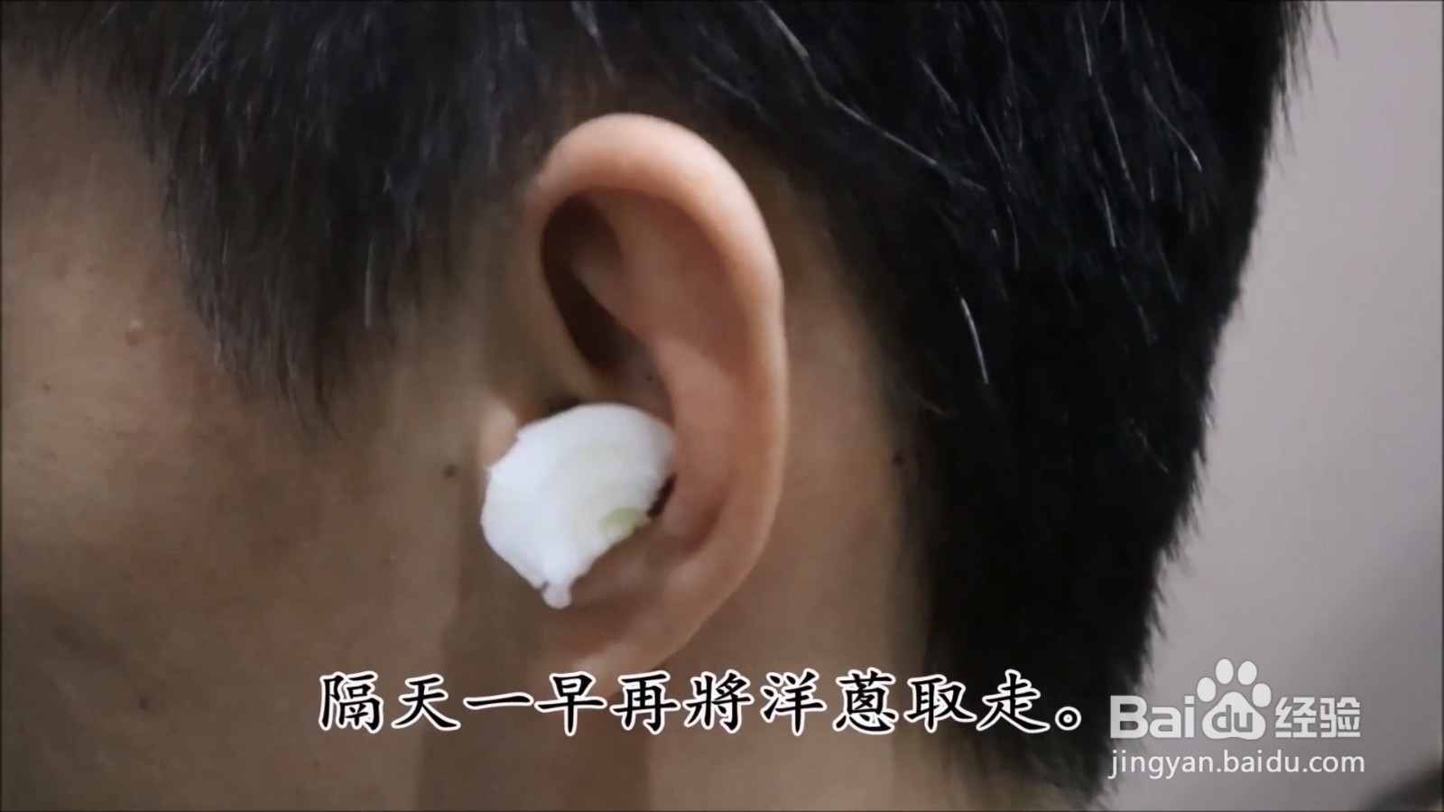 如何缓解耳朵感染？