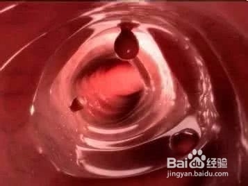 身体出现3多2痛 趁早就医