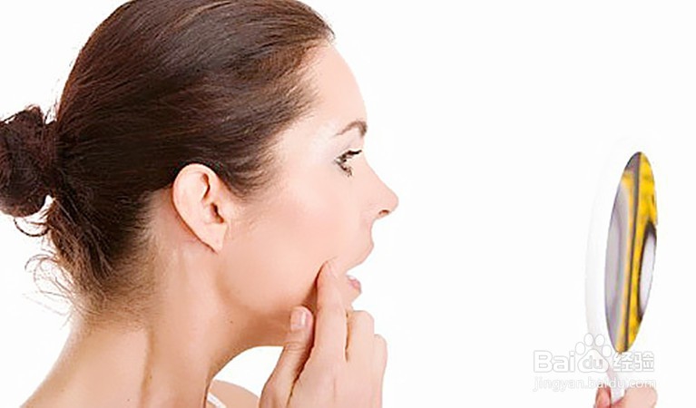 用“白醋”祛痘、消炎