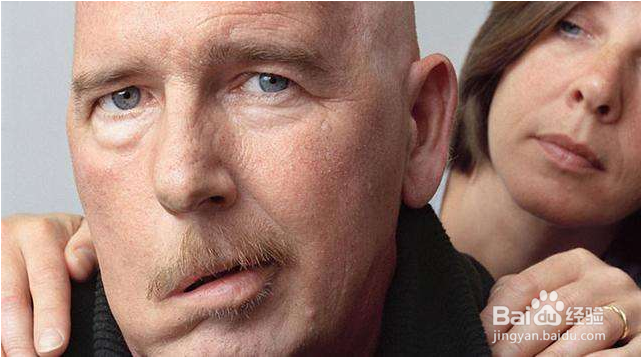 身体有这些颈椎病症状,这样治疗效果最好