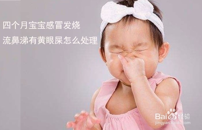 <b>四个月宝宝感冒发烧流鼻涕有黄眼屎怎么处理</b>