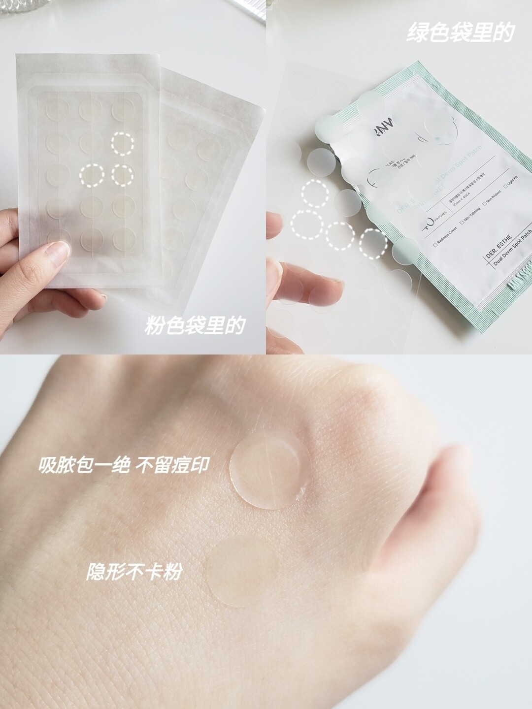 韩国博主真正爱用祛痘好物！