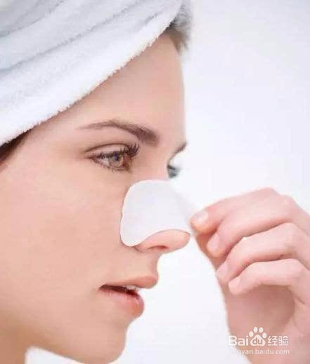 黑头太深了怎么办