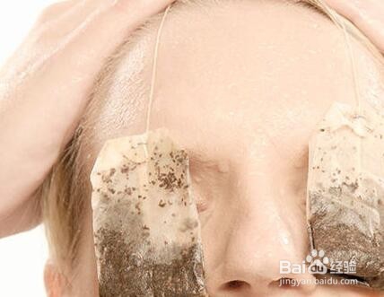 怎么去黑眼圈最有效