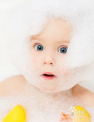 婴儿奶癣治疗的各种方法大全