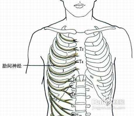 肋间神经痛自疗12法