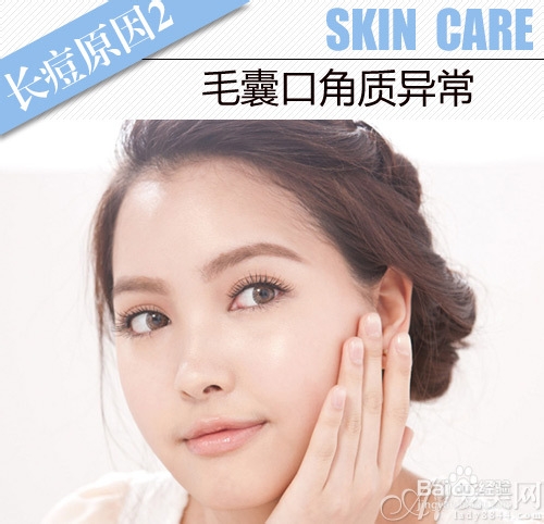 冬日祛痘只需4步