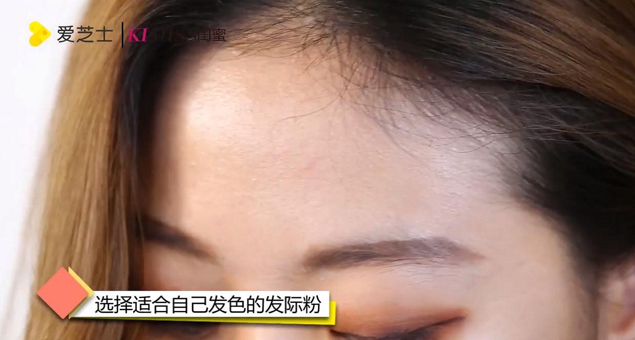 如何调整发际线