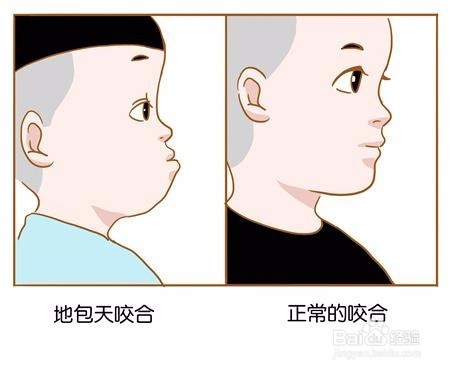 关于武汉牙齿矫正,我们需要知道的。。。