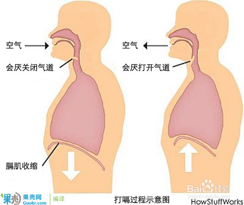 突然一直打嗝不止怎么办？打嗝怎么快速解决？