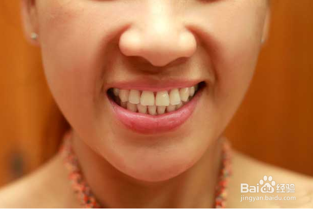 如何变白牙齿