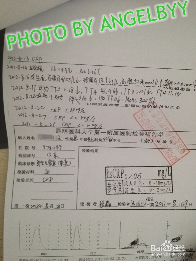 家有早产儿之呼吸暂停等问题