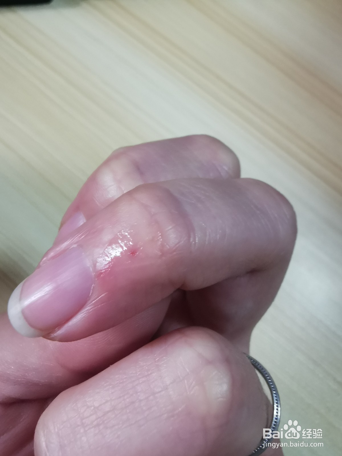 液体创可贴怎么用