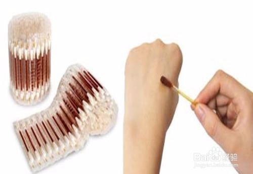 被打过疫苗的小猫咬出血了怎么办