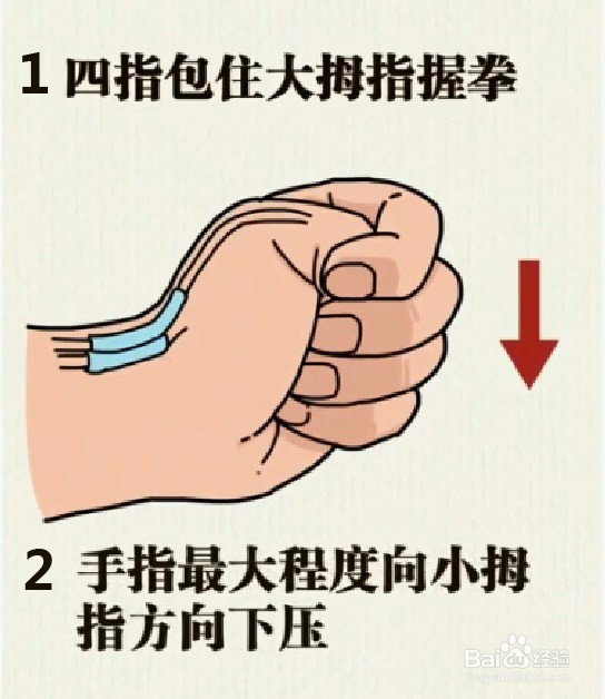 生完孩子后才知道什么是妈妈手，得了它好痛苦