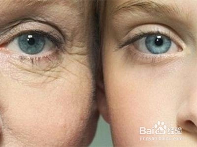 这8种肌肤问题概括了99%的人,你中了几枪?