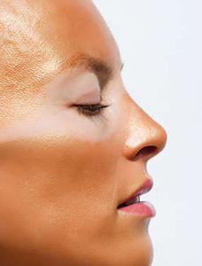 怎样消除雀斑痘印,四类护肤法让你白净一下