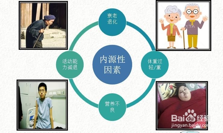 什么是压力性损伤