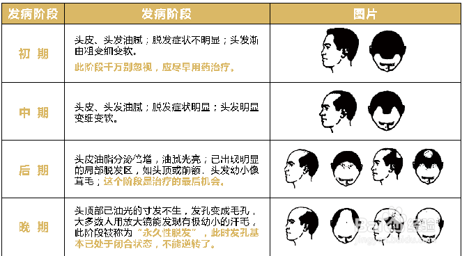 脂溢性脱发的原因及注意方法