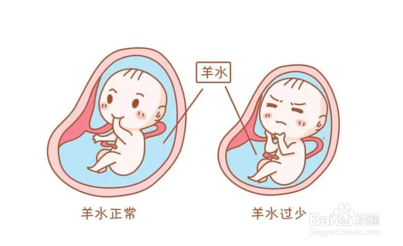 孕晚期羊水少的影响