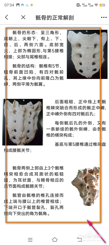 怎么查看3Dbody骶骨解刨变异