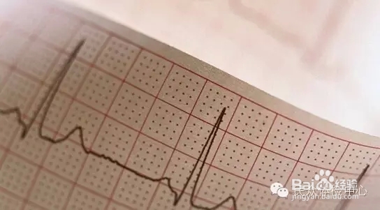 心电图检查有什么作用