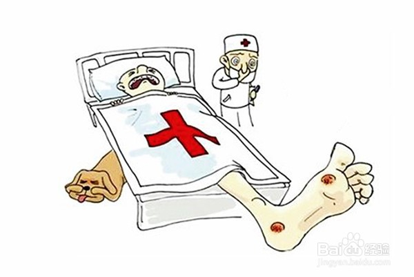 糖尿病足的分级与对应症状