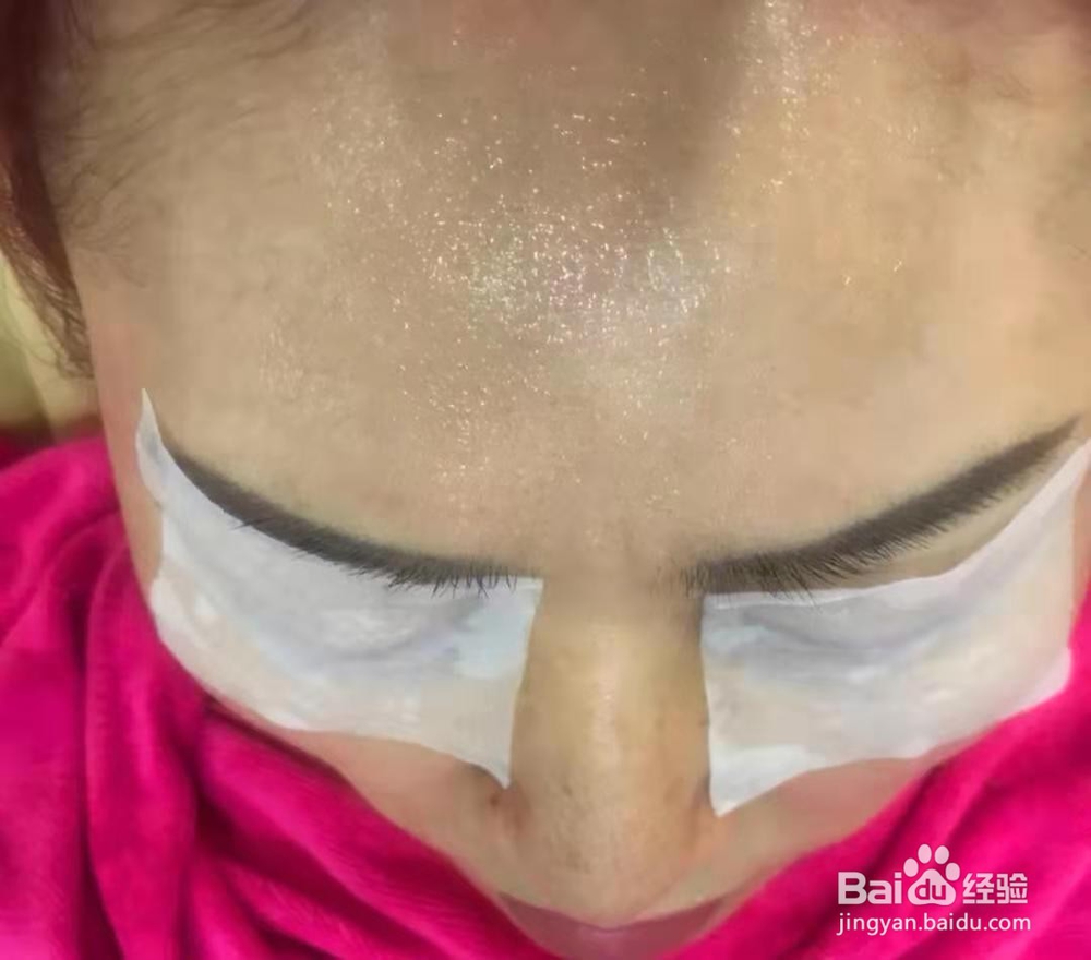 如何快速消除水肿