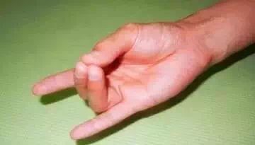 排毒、补肾养肝、明目强心的三个手印