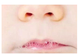 婴幼儿常见问题