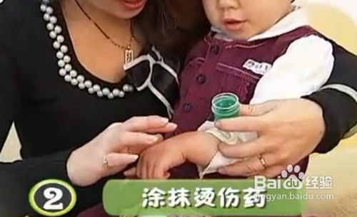 宝宝烫伤怎么办？