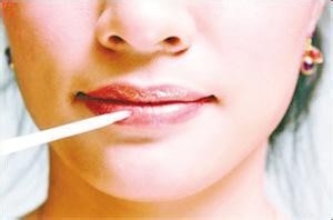 嘴唇干裂了怎么办?