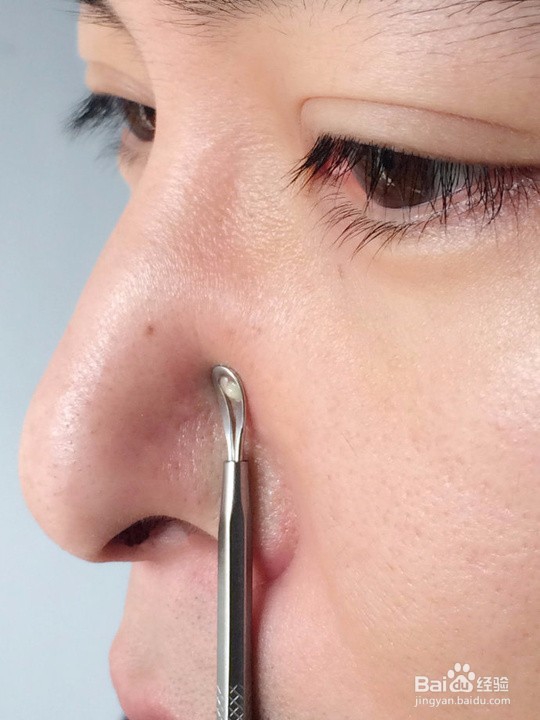 怎样可以减少青春痘