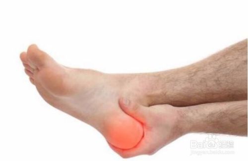 得骨膜炎的原因是什么 百度经验