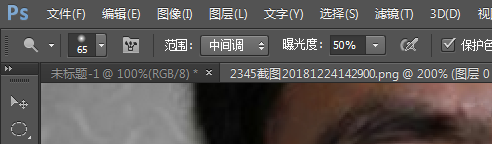 祛痘印最快的方法